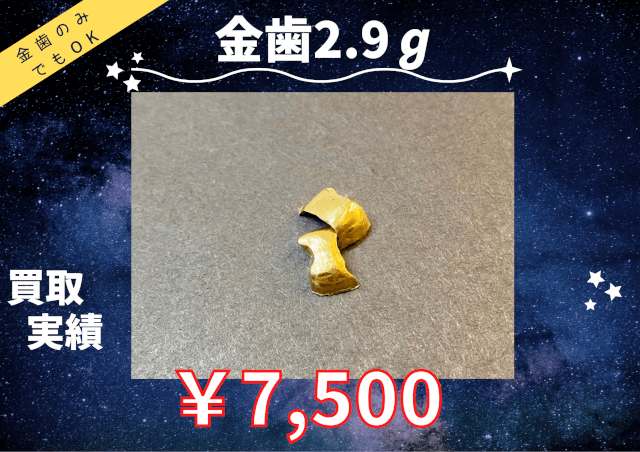 金歯2.9ℊ￥7,500でお買取させていただきました(^^♪