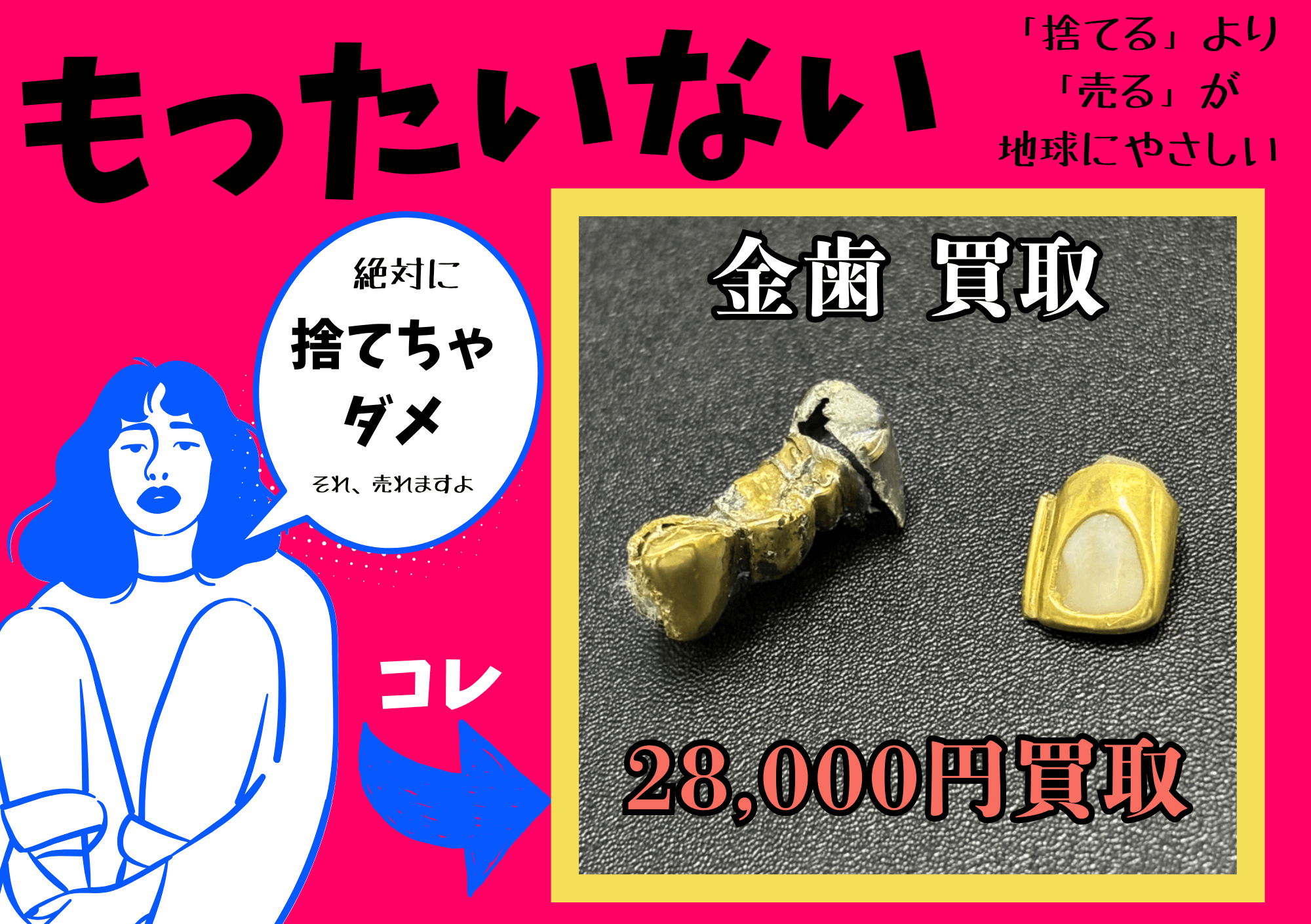 金歯買取 28000円で金歯のお買取しました。もったいない！絶対に捨てちゃダメ！金歯も売れます！