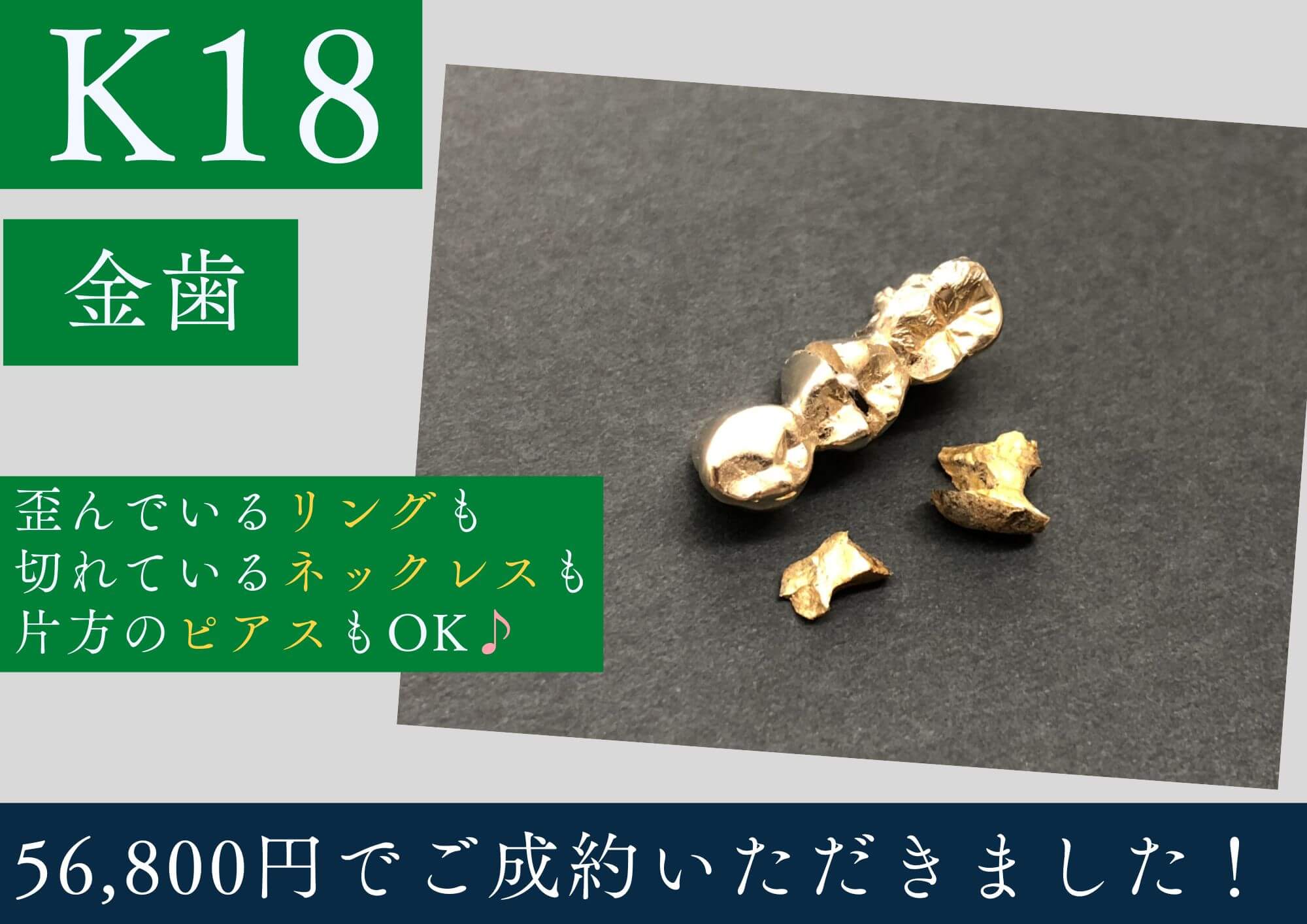 K18 18金 金歯 56,800円でお買取させていただきました！