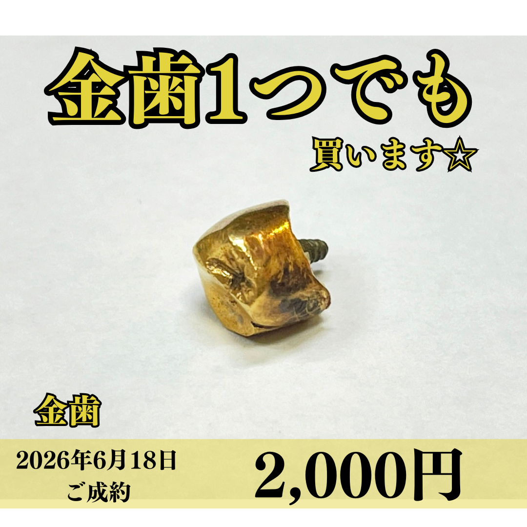 金歯を2,000円で買いました！